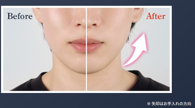 DISM美顔器　効果